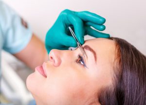 Blepharoplasty Dubai