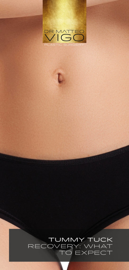 TUMMY TUCK RECOVERY: WHAT TO EXPECT