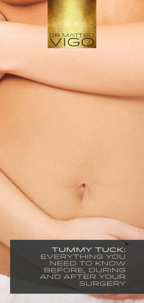 TUMMY TUCK:  EVERYTHING YOU NEED TO KNOW BEFORE, DURING AND AFTER YOUR SURGERY