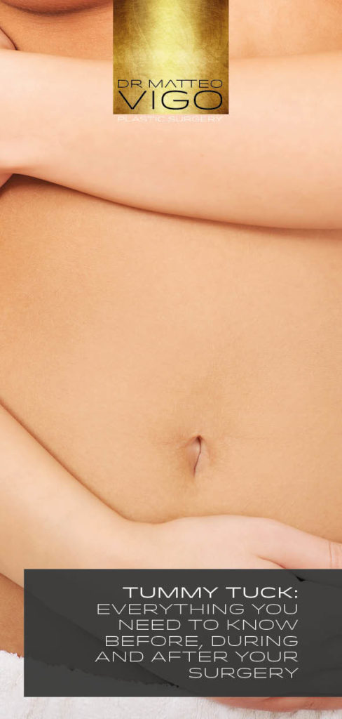 TUMMY TUCK: EVERYTHING YOU NEED TO KNOW BEFORE, DURING AND AFTER YOUR SURGERY