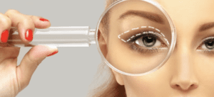 Blepharoplasty Dubai