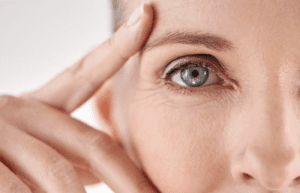 Blepharoplasty Dubai