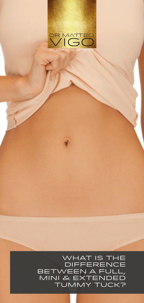 WHAT IS THE DIFFERENCE BETWEEN A FULL, MINI & EXTENDED TUMMY TUCK?