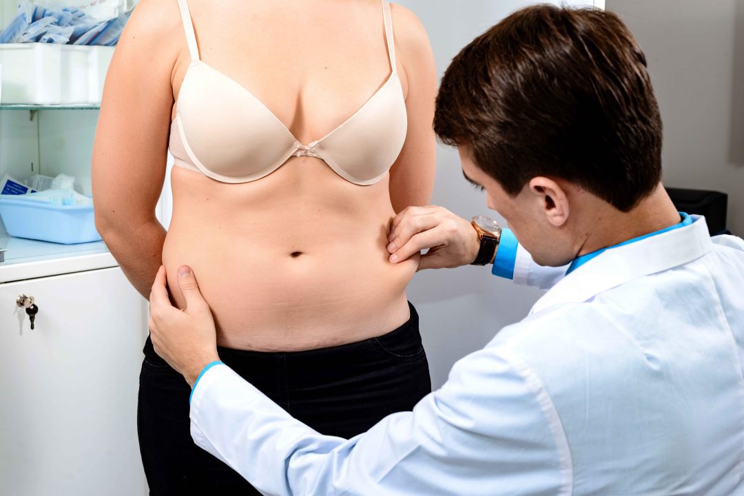 Tummy Tuck in Dubai Abu Dhabi - Best Tummy Tuck Surgeon Dubai Abu Dhabi