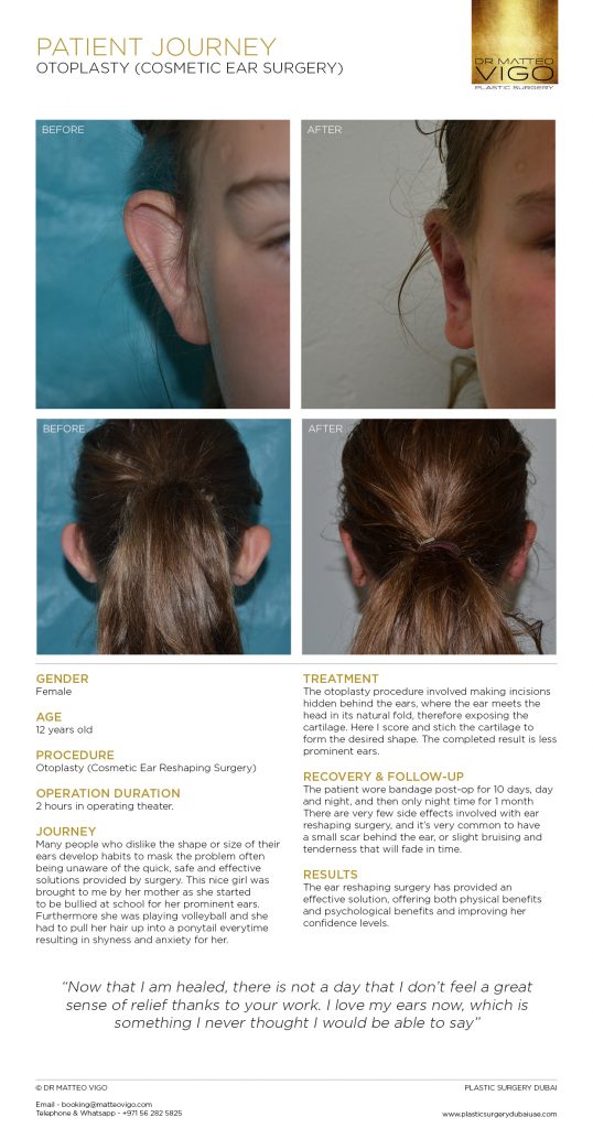 OTOPLASTY (COSMETIC EAR SURGERY)