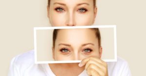 Blepharoplasty Dubai