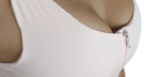 Breast Augmentation Dubai