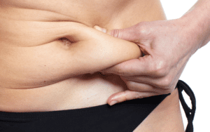 Tummy Tuck Dubai
