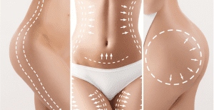 Cosmetic Clinic Dubai