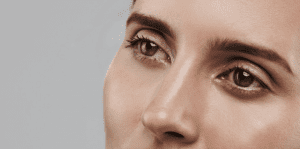 Blepharoplasty Dubai