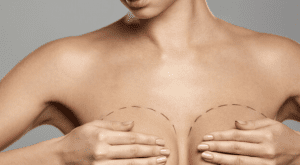 Breast Augmentation Dubai