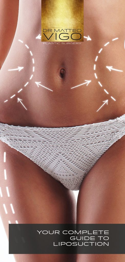 Your Complete Guide to Liposuction