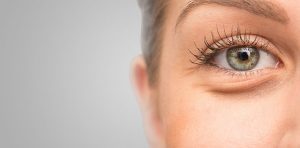 Blepharoplasty Dubai