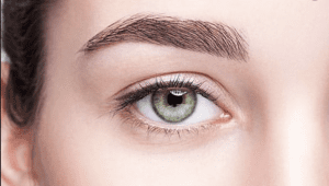 Blepharoplasty Dubai