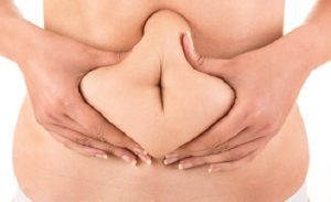 Tummy Tuck Dubai