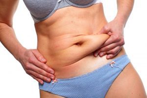 Tummy Tuck Dubai