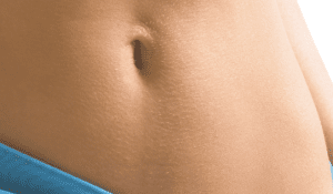 Tummy Tuck Dubai