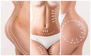 Cosmetic Surgery Dubai