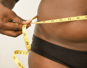 Tummy Tuck Dubai