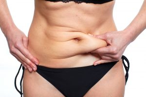 Tummy Tuck Dubai