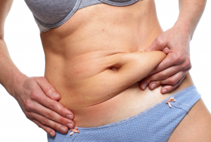 Abdominoplasty Dubai