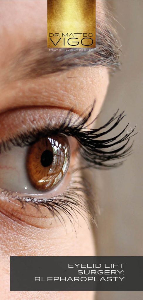 Eyelid Lift Surgery: Blepharoplasty