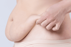 Tummy Tuck Dubai