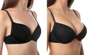 Breast Augmentation Dubai