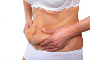 Tummy Tuck Dubai