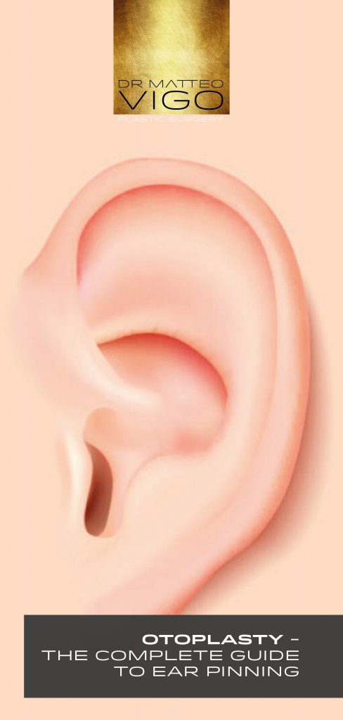 OTOPLASTY – THE COMPLETE GUIDE TO EAR PINNING