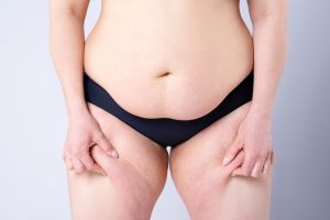 ABDOMINOPLASTY DUBAI