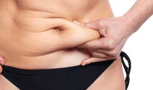 Abdominoplasty Dubai