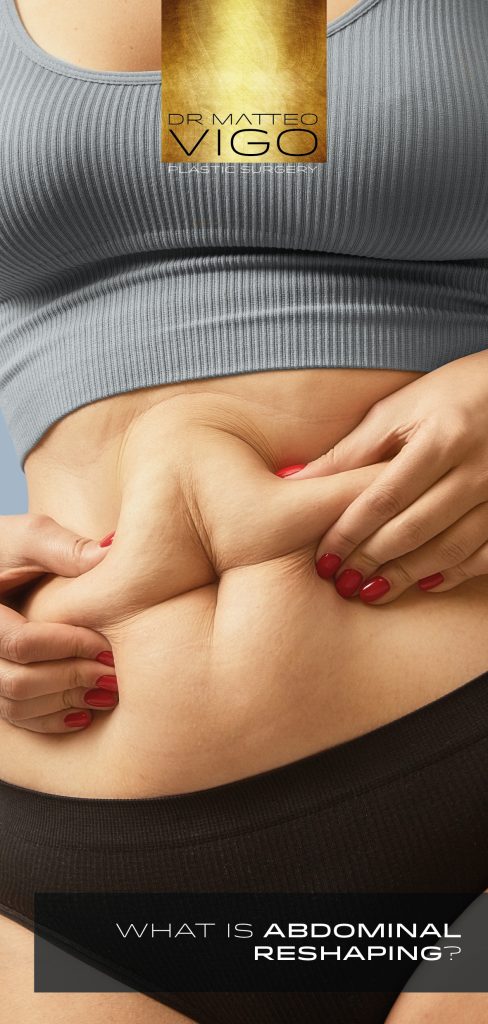 WHAT IS ABDOMINAL RESHAPING?