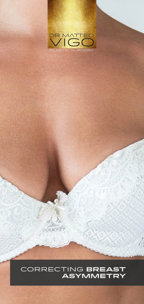 CORRECTING BREAST ASYMMETRY